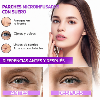 Marcelle™ - Parches Anti-ojeras con Micro-Agujas