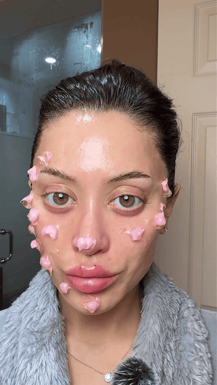 1. Aplica Marcelle™